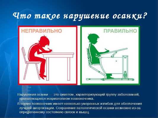 Профилактика нарушения осанки у детей Профилактика нарушения осанки у детей